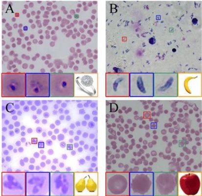  Apicomplexan: A Parasite With A Need For Speed And An Affinity For Blood!