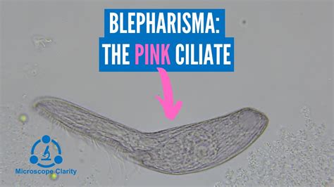  Blepharisma: Descubra o Espetáculo Brilhante dos Ciliados que Dançam com a Luz!